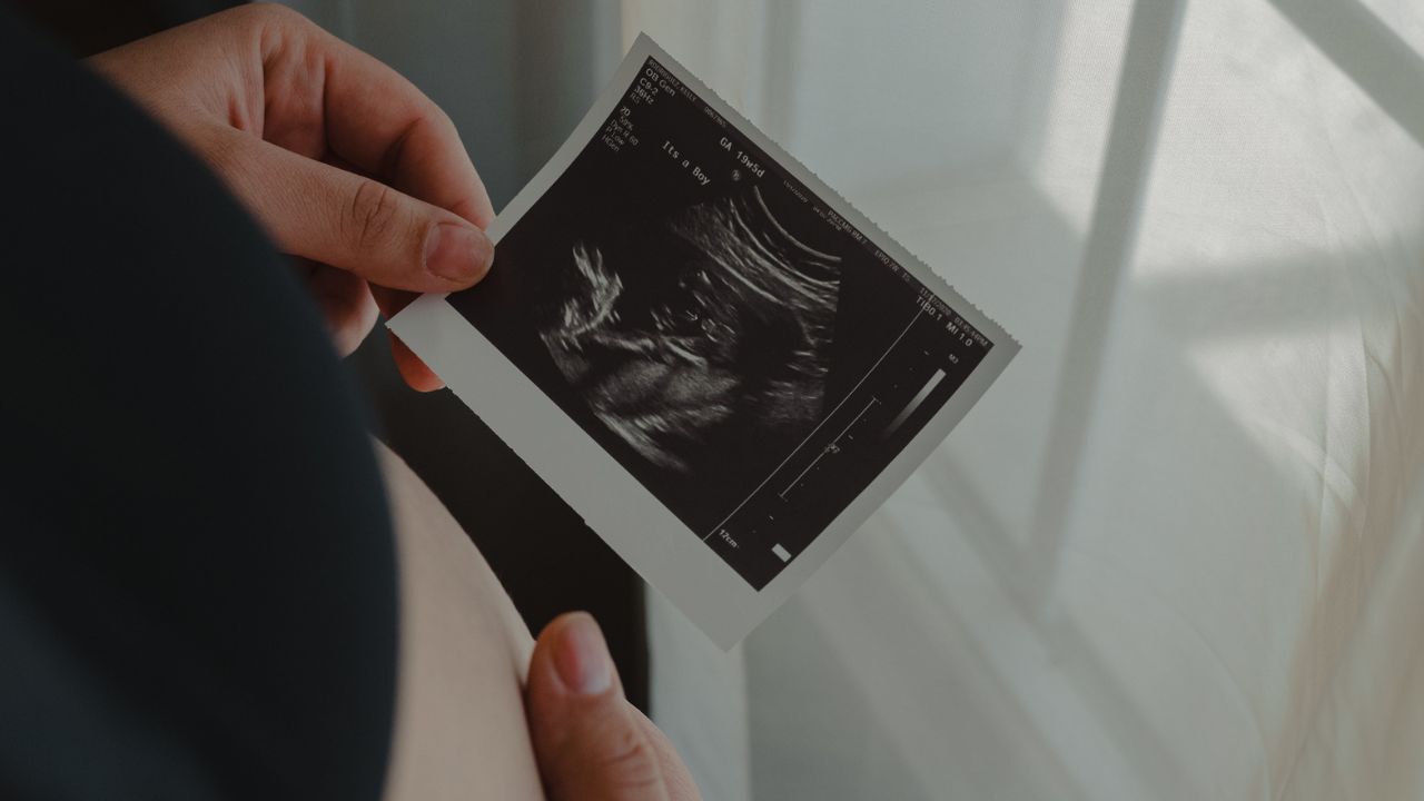 arsuri la stomac, dureri de cap, creștere în greutate și vergeturi